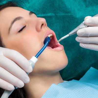 Park Dental Dentálhigiéniai kezelések